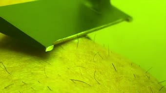 Laserscheermes verwijdert met grootste moeite haren