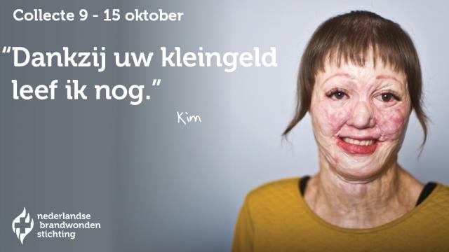 Facebook keurt advertentie Brandwondenstichting af